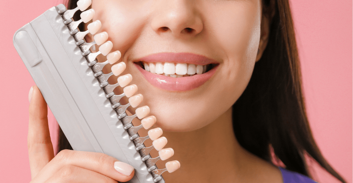 What are Dental Veneers? Are Veneers Right for Me? - Mills Haven Dental