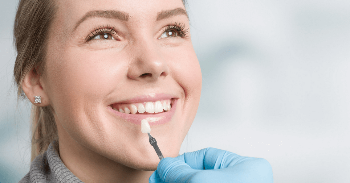What are Dental Veneers? Are Veneers Right for Me? - Mills Haven Dental
