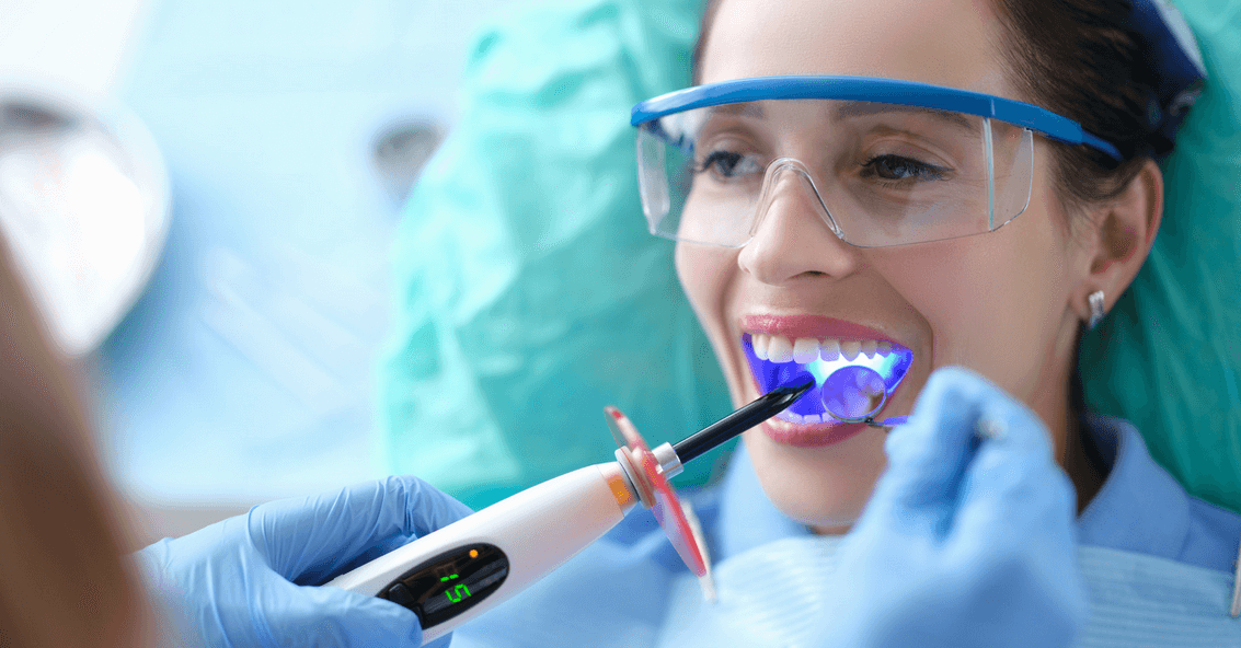 Ideal Candidates for Dental Bonding - Mills Haven Dental